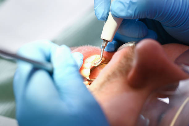 Best Urgent Dental Care for Toothache in San Rafael, NM