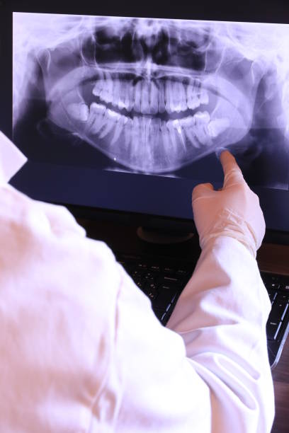Best Emergency Root Canal Treatment in San Rafael, NM