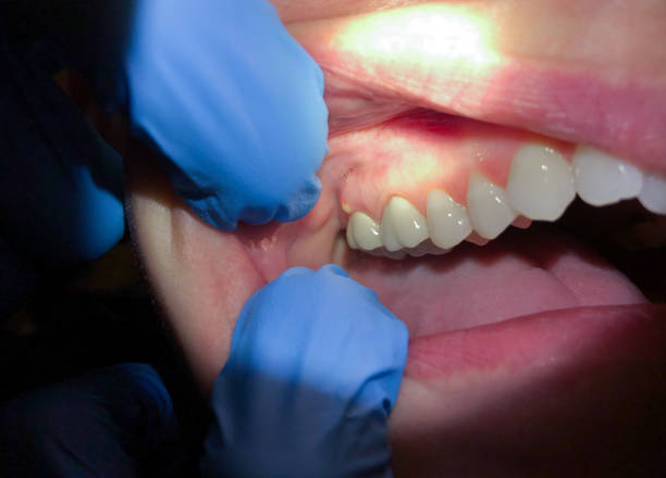 Best Emergency Dentist for Special Needs Patients in San Rafael, NM
